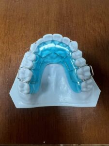 Removable Ortho