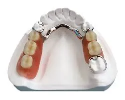 Metallic Denture (Per Jaw)