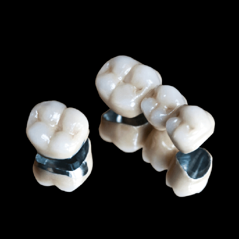 Porcelain Crown and Bridge - Image 3