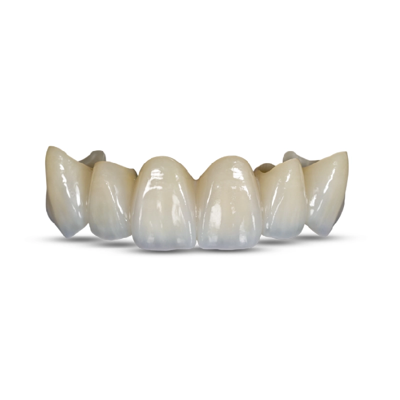 Zirconium Crown - Image 5