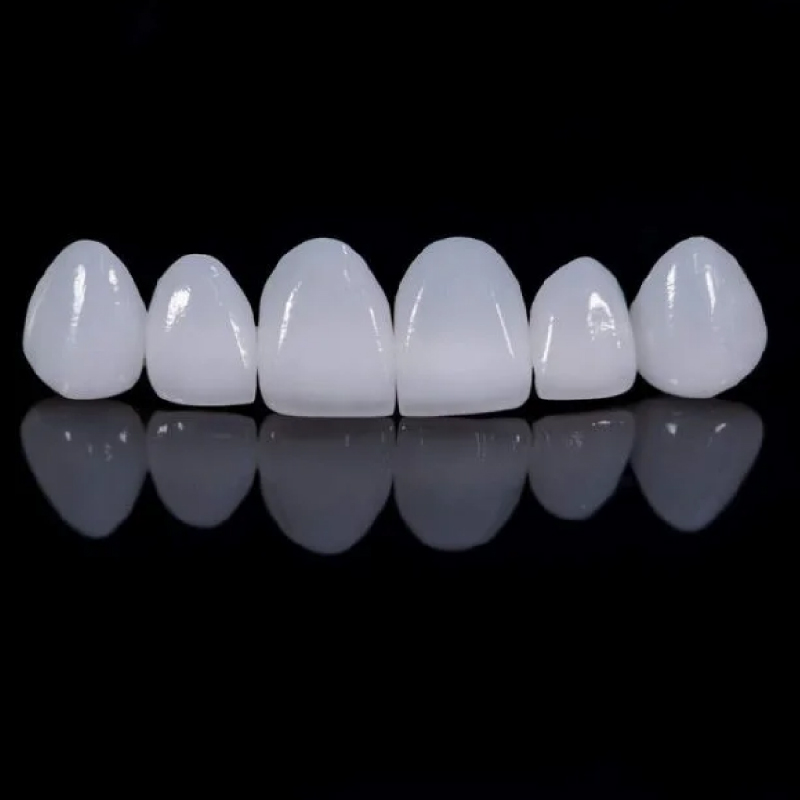 Zirconium Crown - Image 4