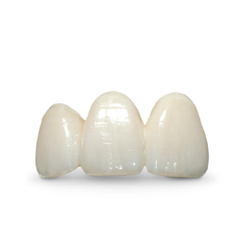 E.MAX Crown - Image 3