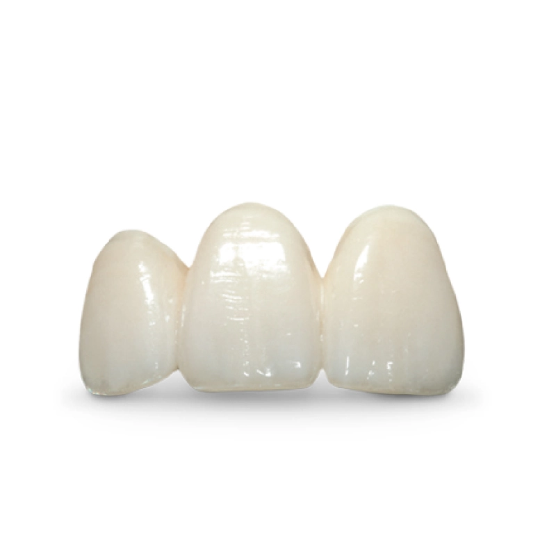 E.MAX Crown - Image 2