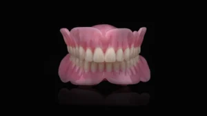 Heat Cure Denture