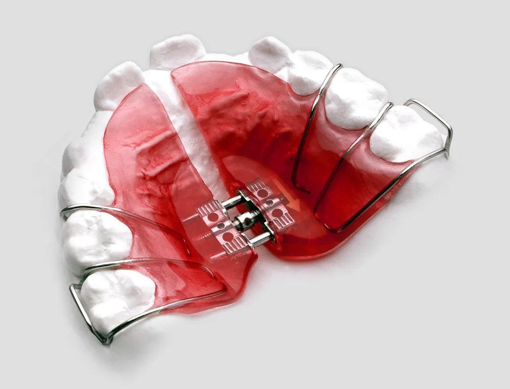 Expansion Screw - Image 3